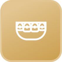 Teeth Alignment