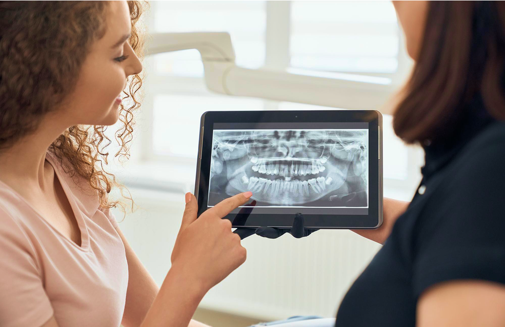 Intra Oral Scanning