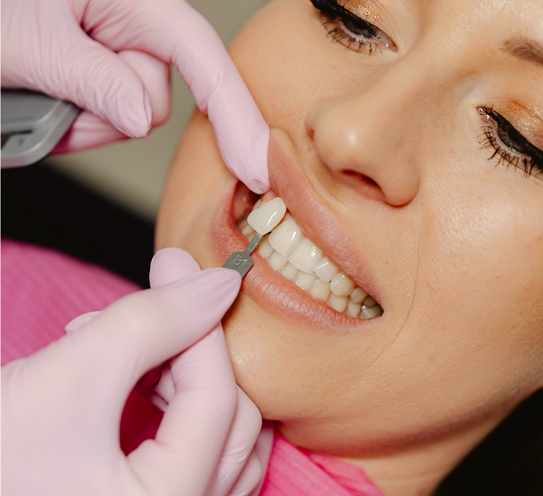 cosmetic-dentistry