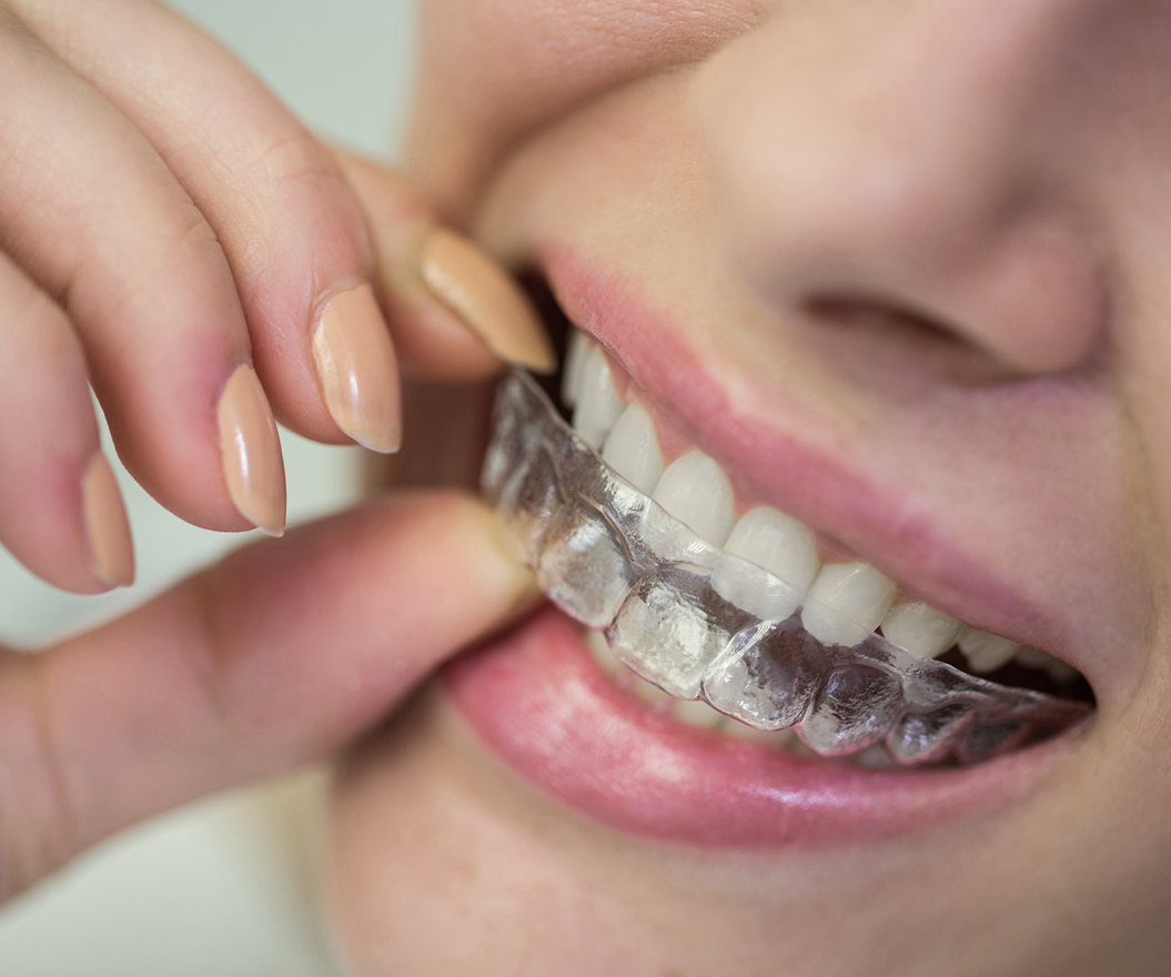 orthodontics