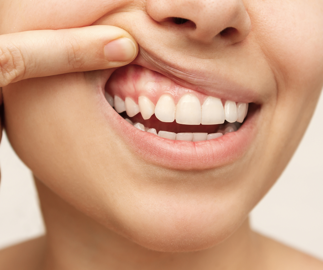 periodontics about img